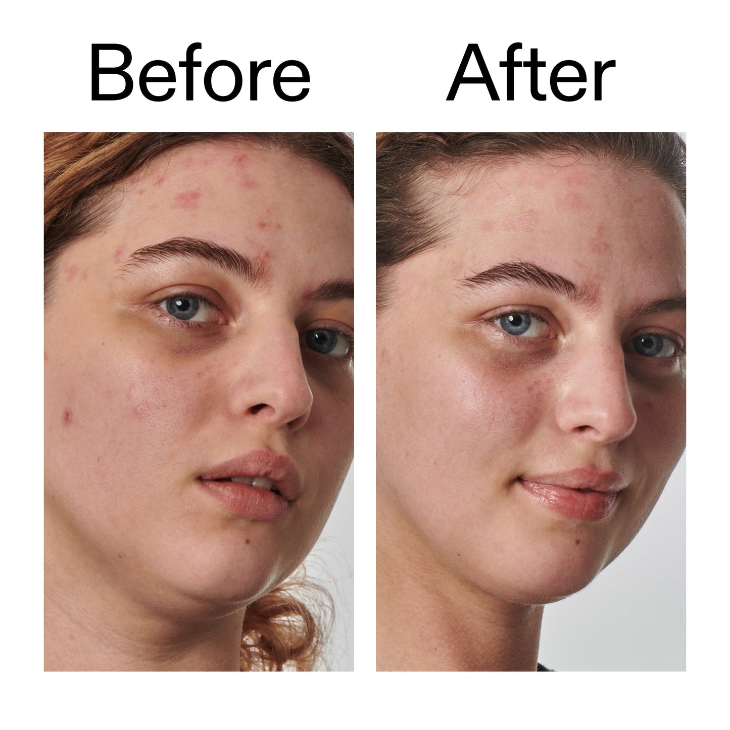 10-urea-moisturizer-q4 Dry_and_Rough_Skin_Solution_Before_After_2000x2000_efa6e639-5c39-49bd-a5dd-f0220293120a.jpg
