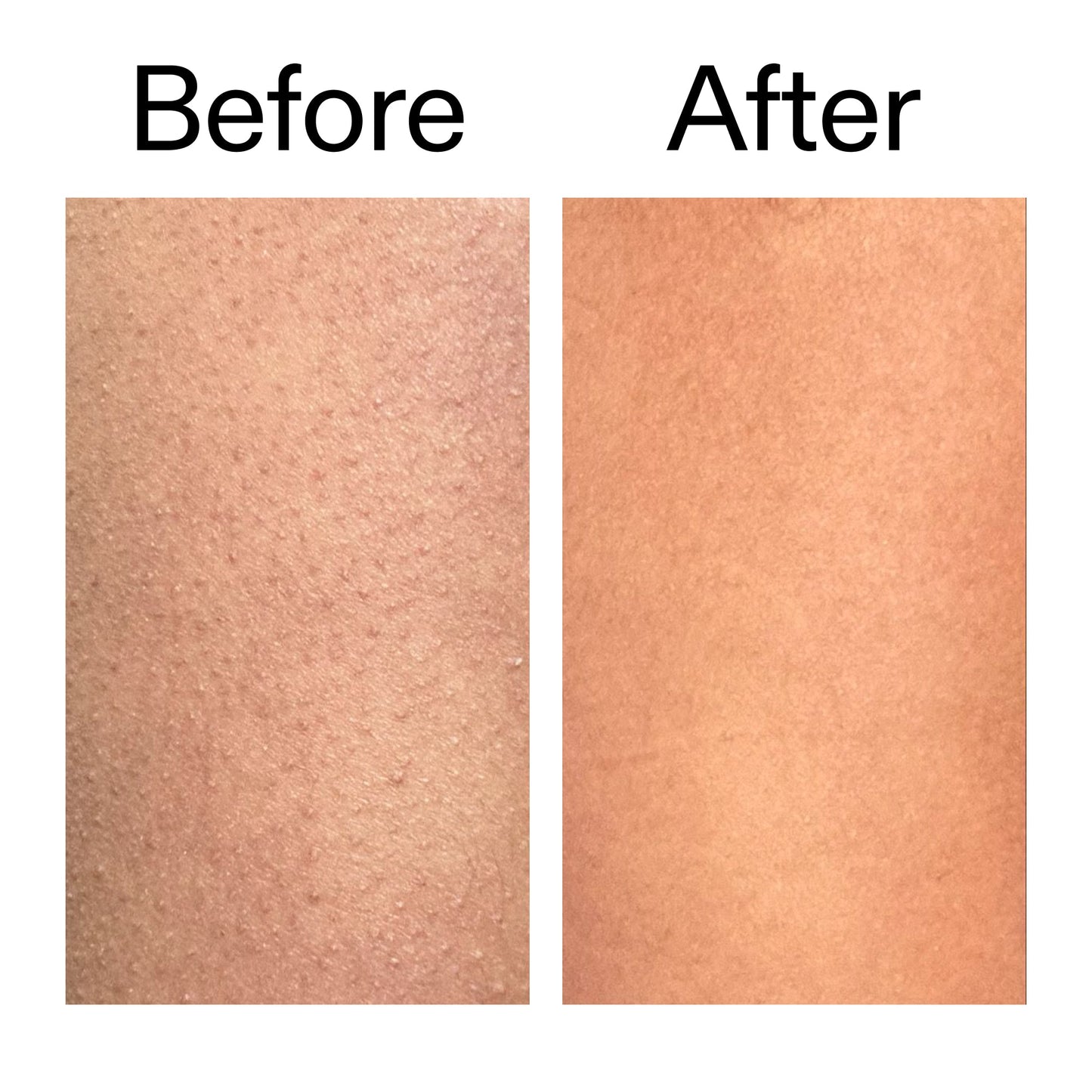 glycolic-acid-exfoliating-body-stick-l8 Glycolic_Body_Stick_B_A_2000x2000_6e6e6b4d-5bd7-43c0-aeed-4d66788e8995.jpg