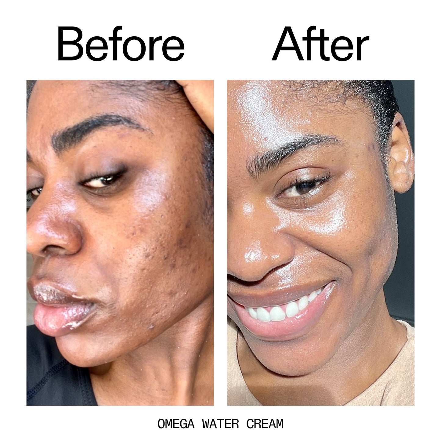hydrating-cleanser-and-moisturizer-duo-d1 Omega_Water_Cream_Before_After_2000x2000_8e88278b-8c8d-48dc-ac77-4e98ebbd1b77.jpg