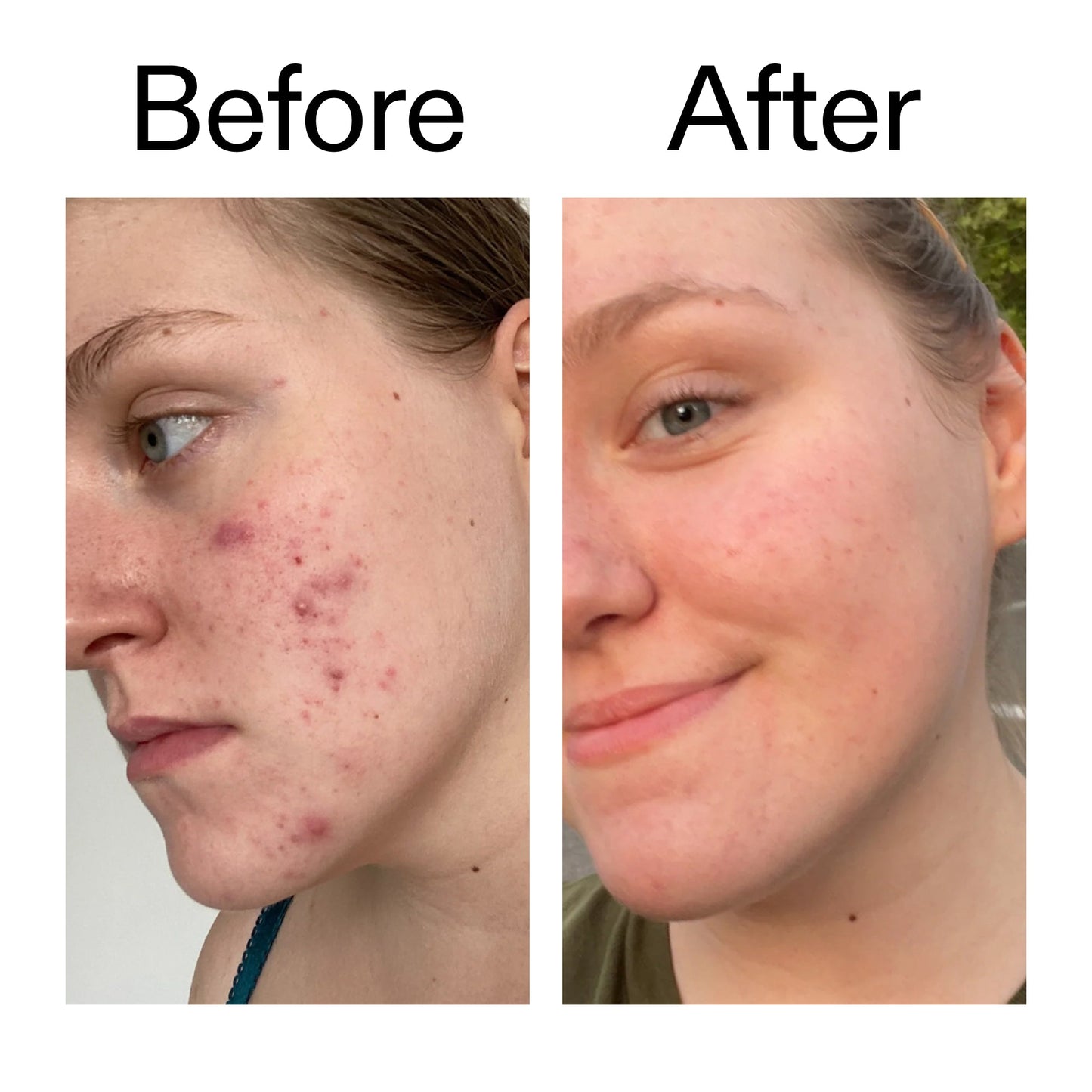 15-vitamin-c-egf-serum-c0 15_Vitamin_C_EGF_Serum_Before_After_2000x2000_fb9f598a-3386-40c8-8143-36f9d7a17ec8.jpg