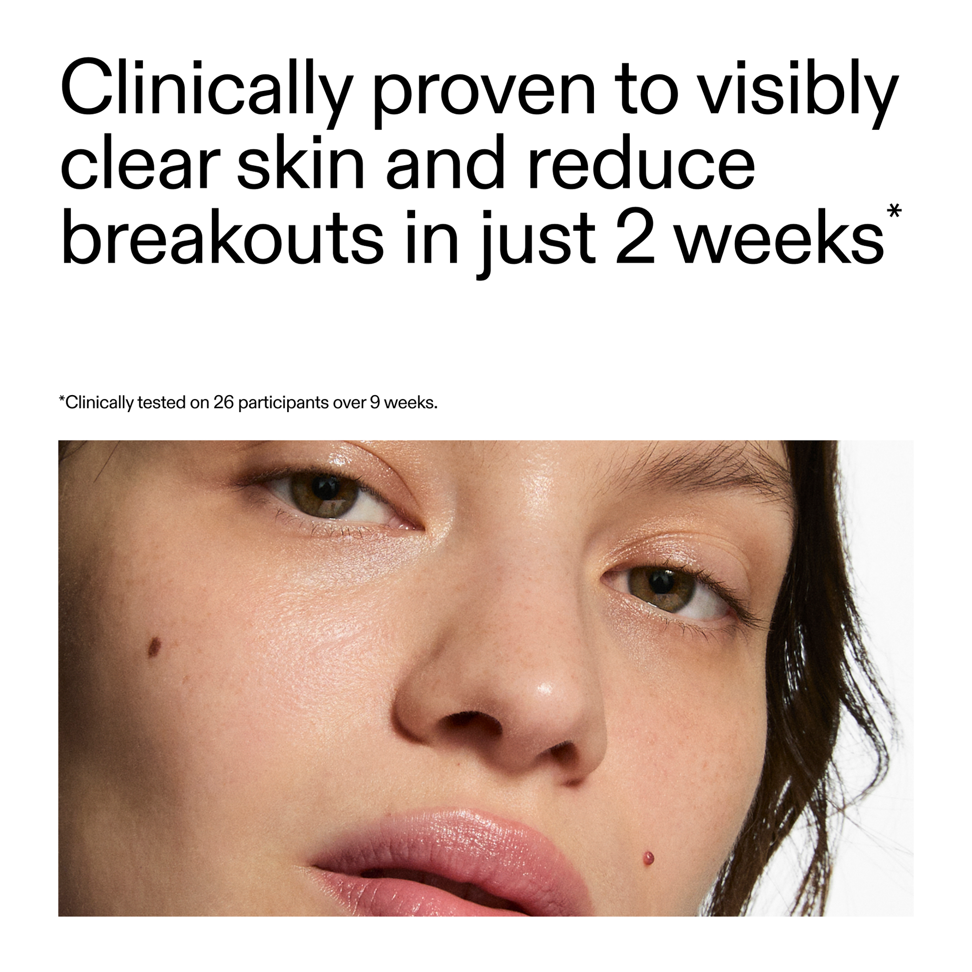 360-acne-clearing-duo-w7 360_Serum_Key_Claim.png