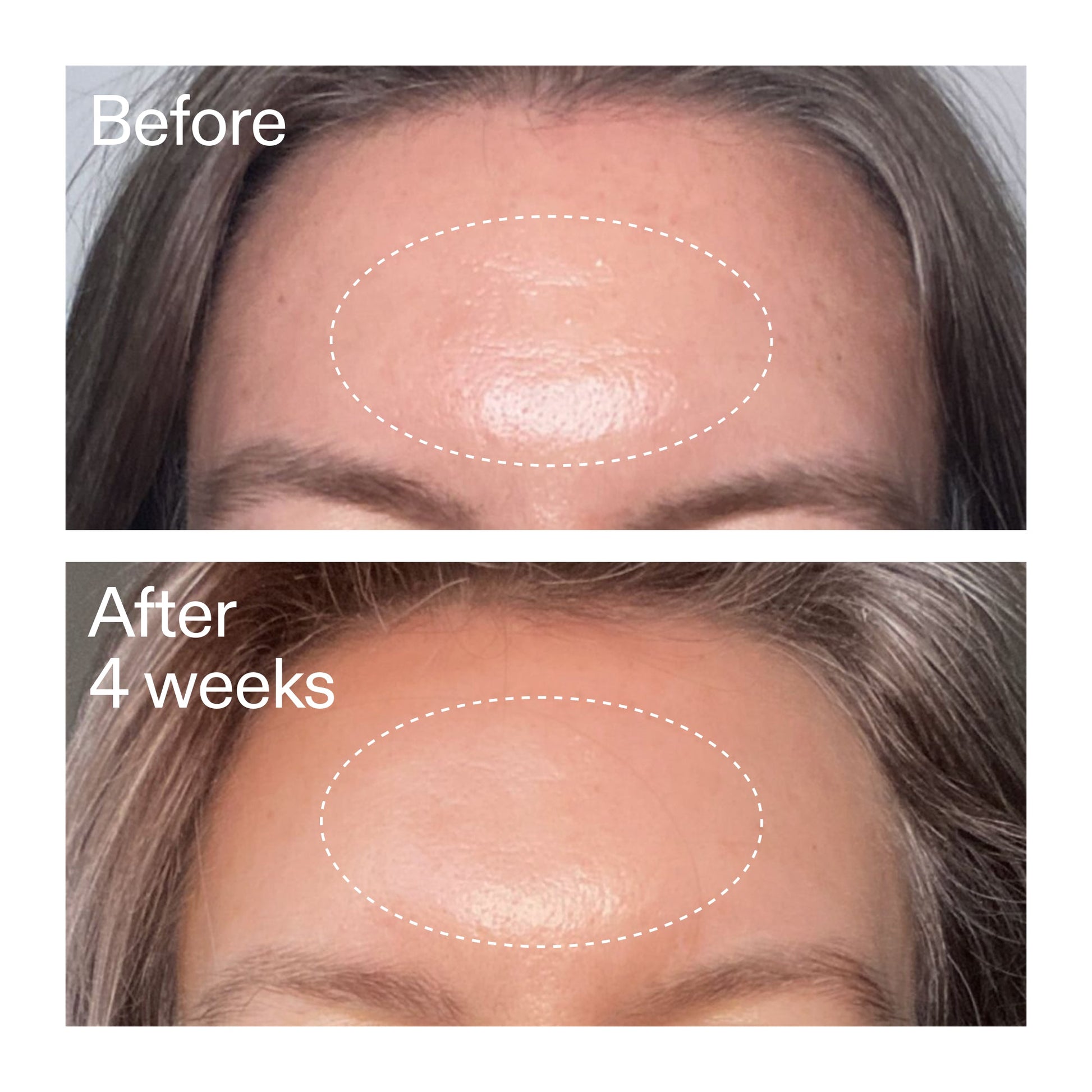 advanced-0-2-retinal-serum-h2 AdvancedRetinal_BeforeAfter1_2000x2000_1da6bb0a-29dd-41d1-95b7-8679696bbf0f.jpg