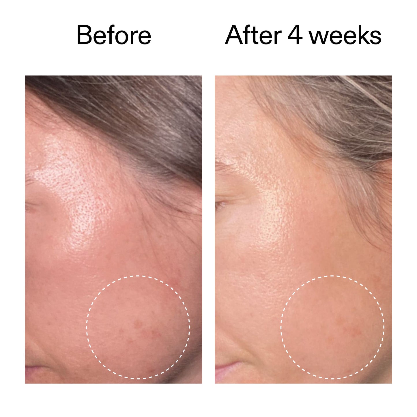 advanced-0-2-retinal-serum-h2 AdvancedRetinal_BeforeAfter2__2000x2000_62fb16bb-77ae-4d63-8500-88dbf847f4b9.jpg