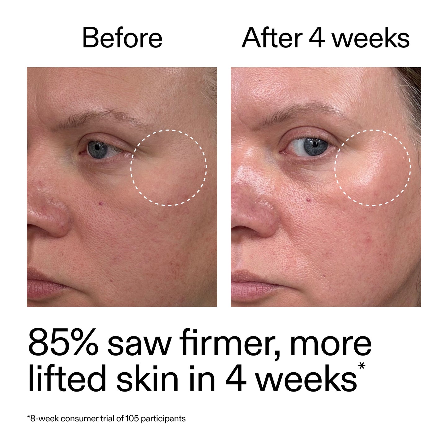 advanced-0-2-retinal-serum-h2 AdvancedRetinal_BeforeAfter_Claim1_2000x2000_bcc385c4-5e73-4f1e-aba8-64267937d0d3.jpg