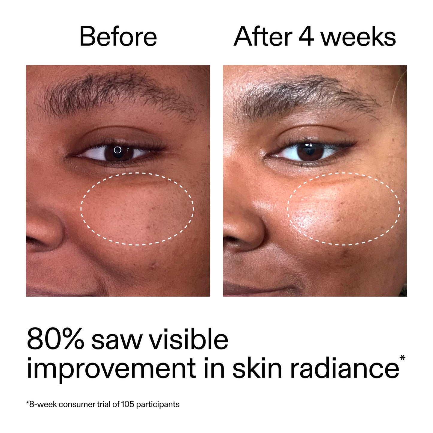 advanced-0-2-retinal-serum-h2 AdvancedRetinal_BeforeAfter_Claim2_2000x2000_39d11e3d-eda9-44ec-ab32-2903b1a368bd.jpg