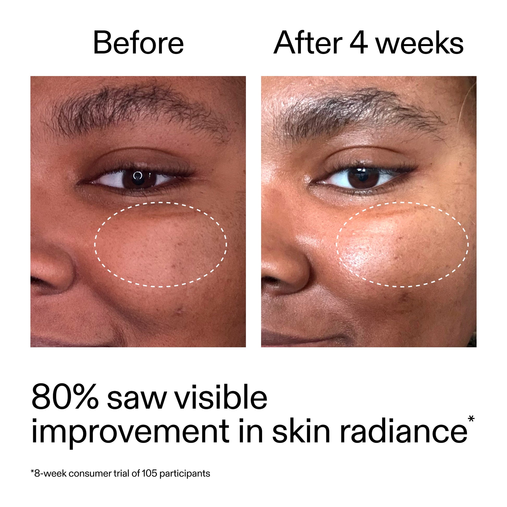 advanced-0-2-retinal-serum-h2 AdvancedRetinal_BeforeAfter_Claim2_2000x2000_39d11e3d-eda9-44ec-ab32-2903b1a368bd.jpg