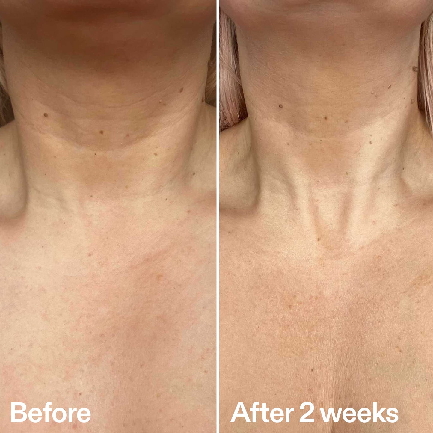 bio-active-neck-lift-stick-j5 B_A_2.jpg