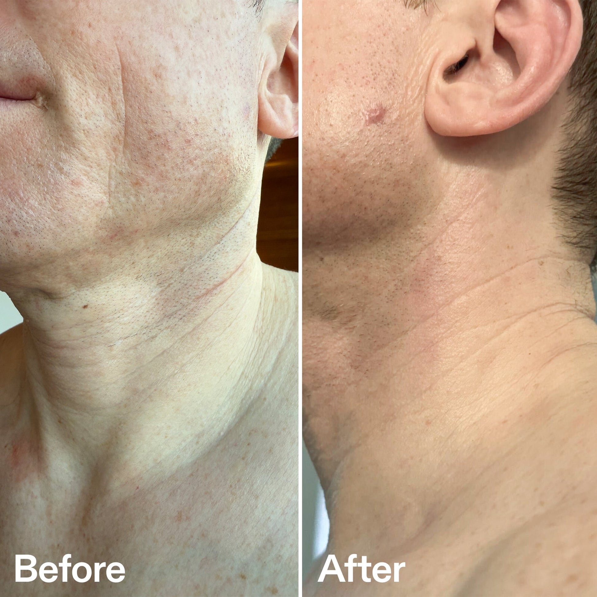 bio-active-neck-lift-stick-j5 B_A_afa2743e-b8e2-4504-92f4-e281cb6cf759.jpg