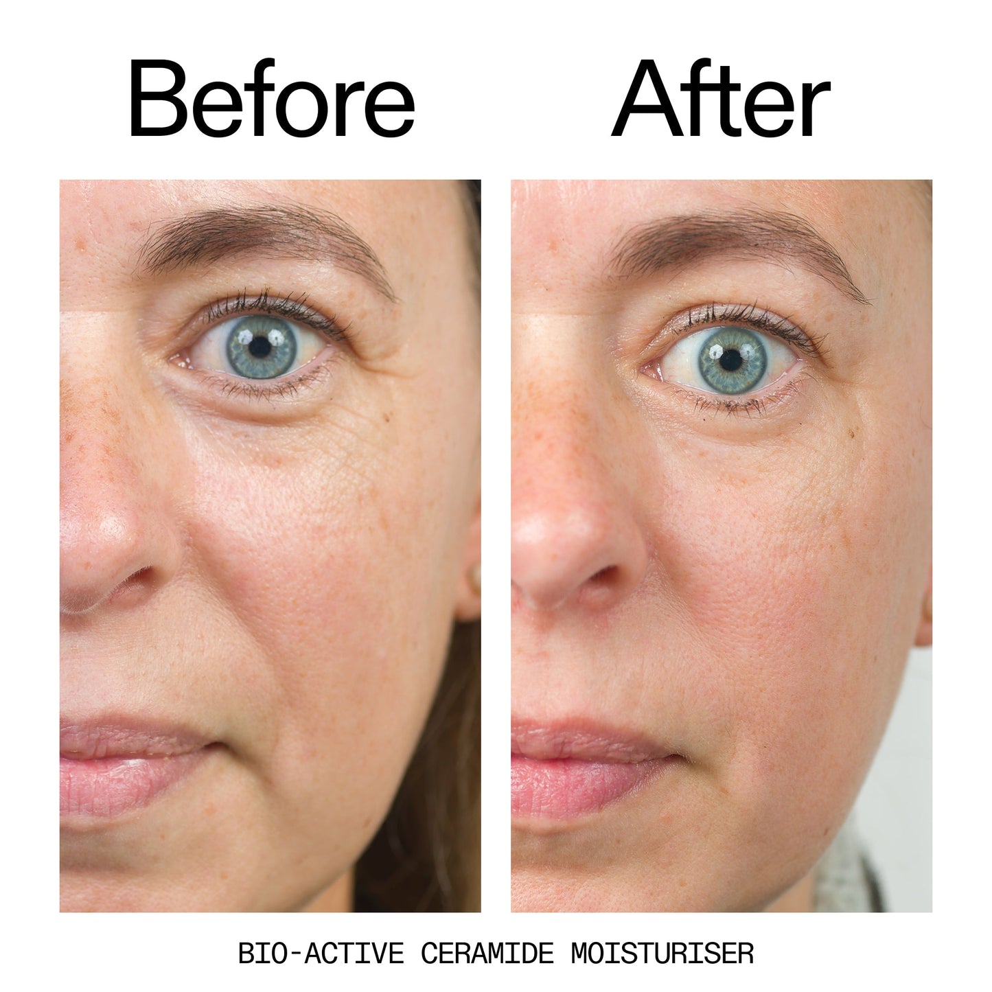 barrier-boosting-trio-k3 Bio-Active_Before_After_2000x2000_600947b4-e8c5-425a-9155-fc15bc83aa12.jpg