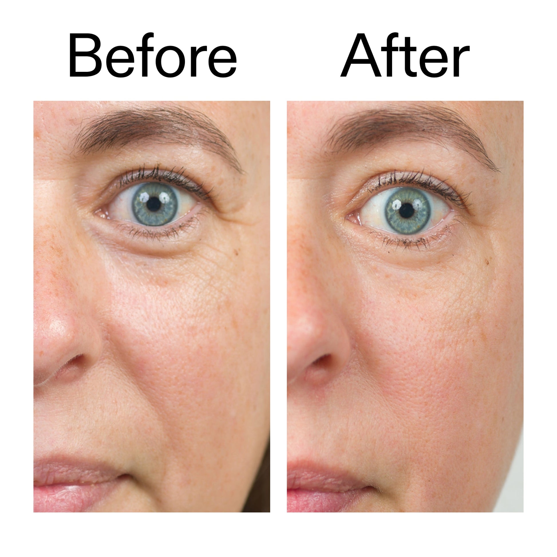 bio-active-ceramide-moisturizer-n0 Bio-Active_Before_After_2000x2000_566e5a9e-135e-417a-8242-b44e5fa35463.jpg