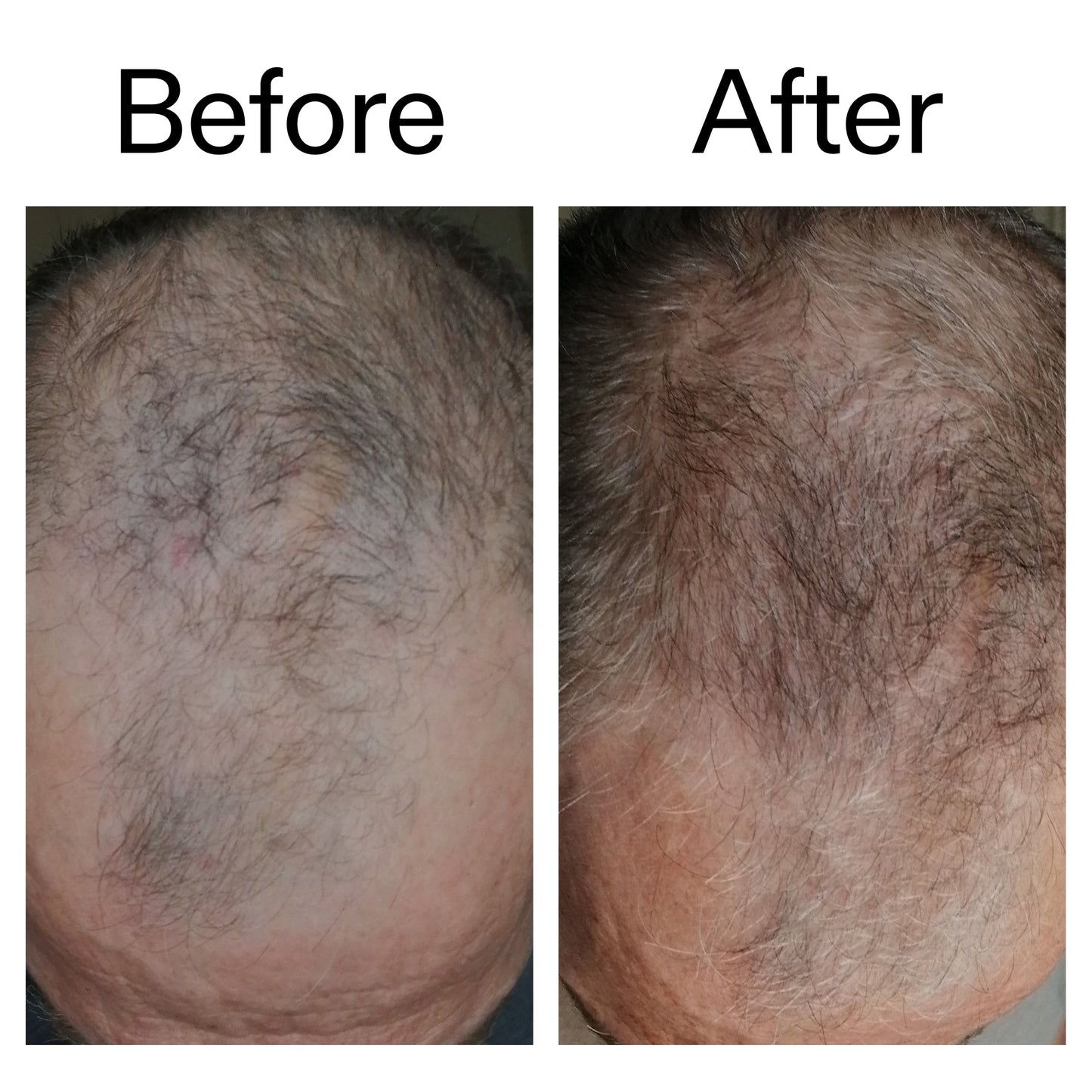 3-month-hair-growth-trio-o8 Caffeine_Scalp_Treatment_B_A_Ppage_2000_x_2000.jpg