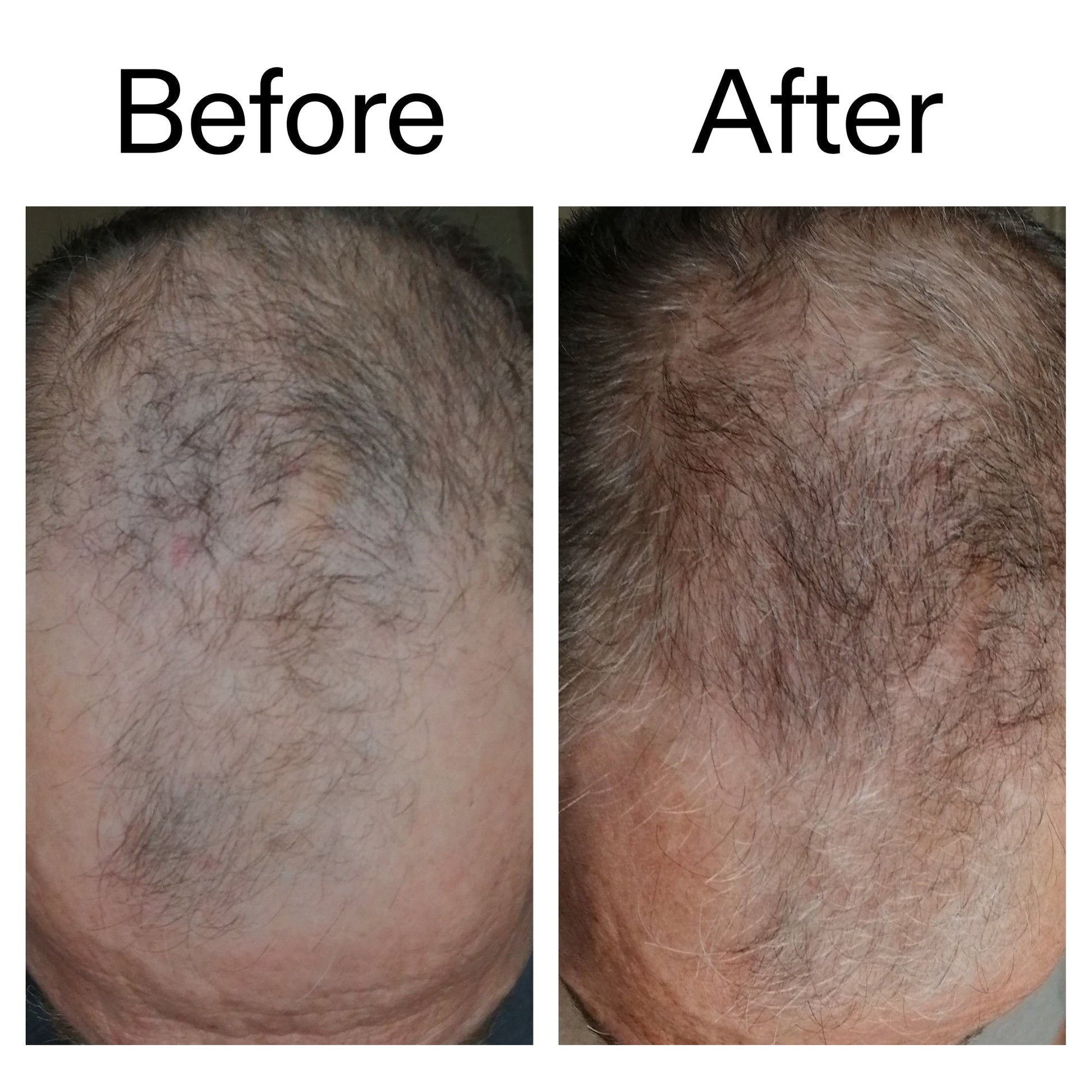 3-month-hair-growth-trio-o8 Caffeine_Scalp_Treatment_B_A_Ppage_2000_x_2000.jpg