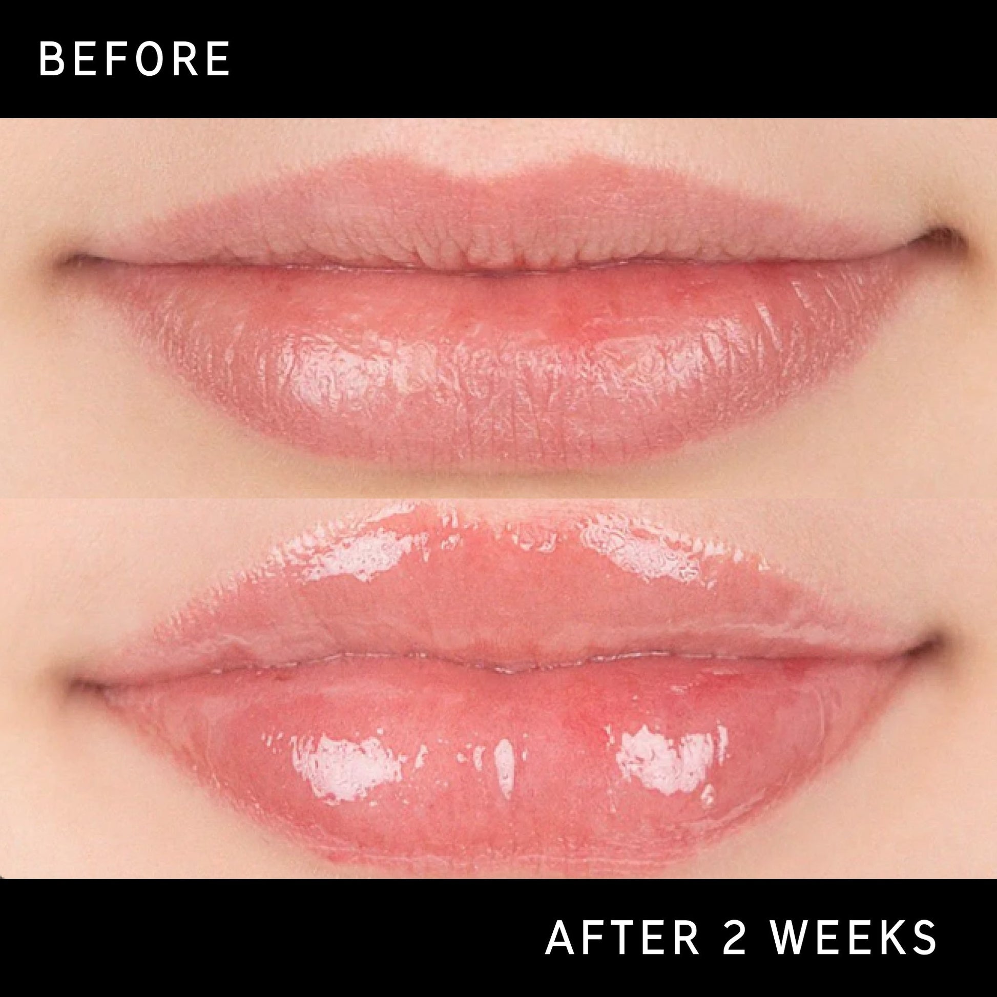 lip-plumping-duo-c0 DTC-Top15_Amends_Tripeptide-Lip_B_A.jpg