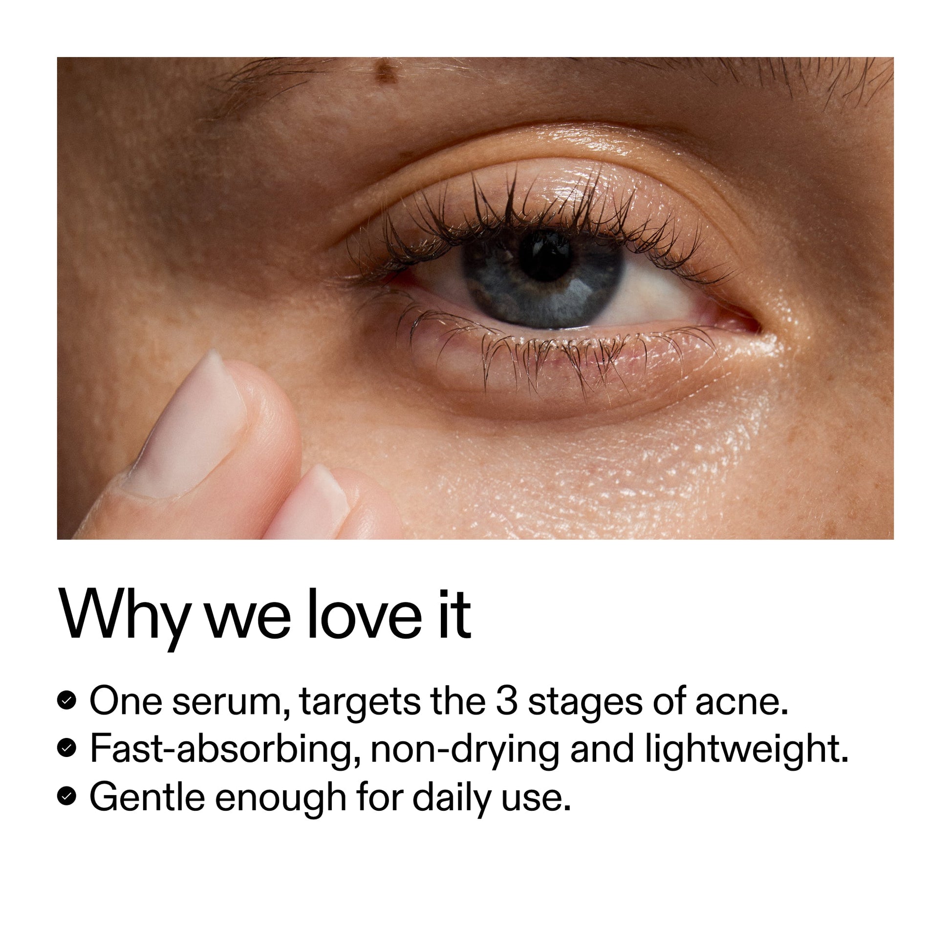360-acne-clearing-duo-w7 Dioic_Whyweloveit_2000x2000_175aafd3-0cbe-403a-b317-a8362881bfe2.jpg