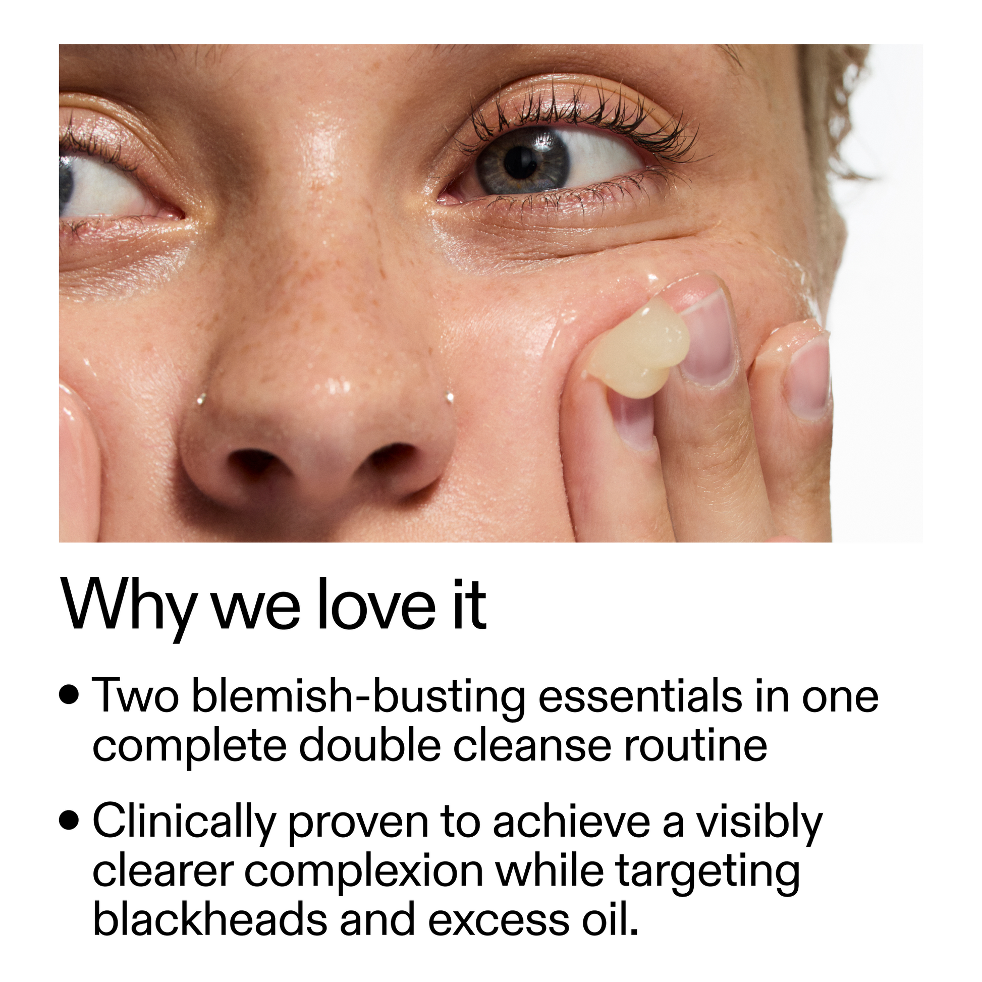 acne-double-cleanse-duo-i0 Double_Cleanse_Duo_for_Breakouts_Why_We_2000x2000_f242cb12-bb5c-487c-b203-071ccb406ec5.png