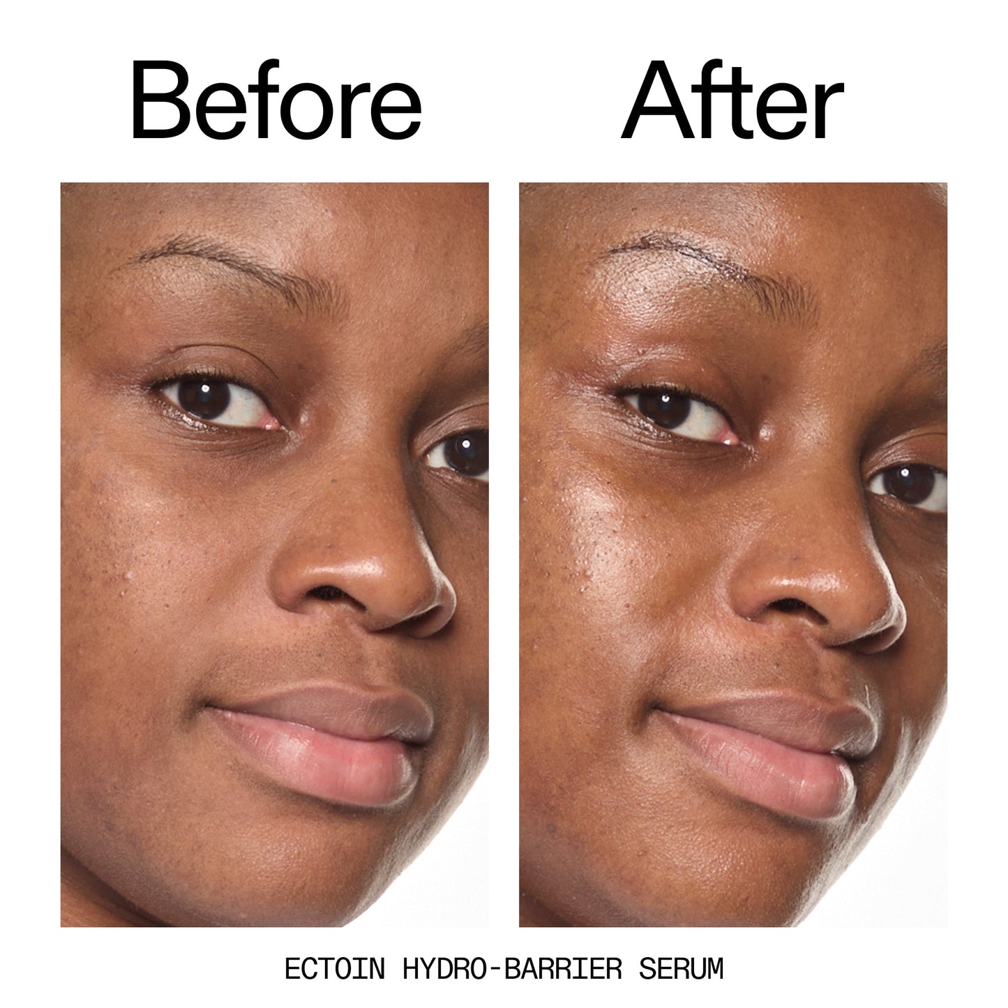 barrier-boosting-trio-k3 Ectoin_Before_After_2000x2000_ce35bc41-4da0-4b6f-adc7-29f8641f6c6c.jpg