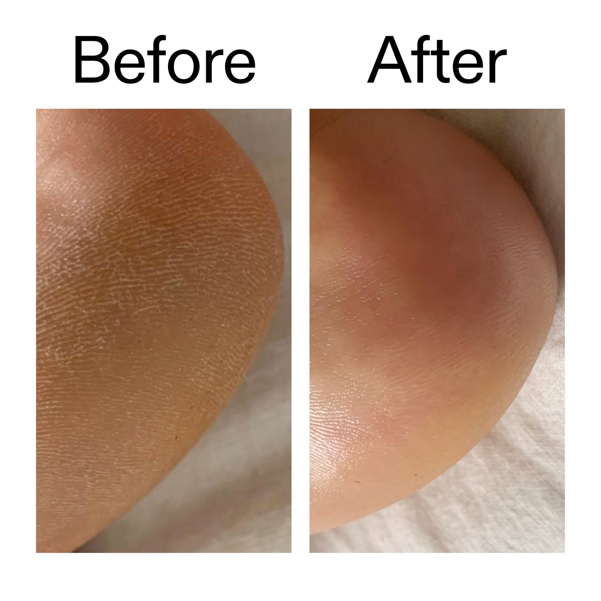 glycolic-acid-exfoliating-body-stick-duo-c9 Glycolic_Acid_Exfoliating_Body_Stick_Before_After_V1_2000x2000_a3043625-9400-429a-a7fb-d6dbd220f722.jpg
