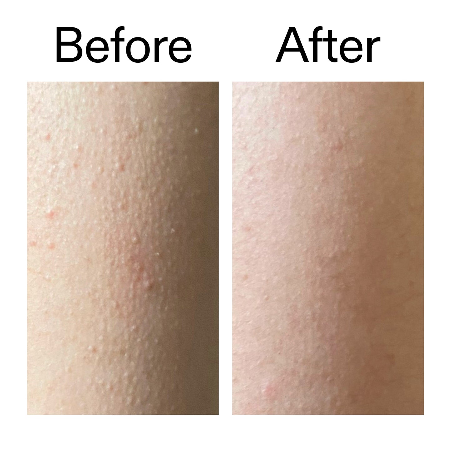 glycolic-acid-exfoliating-body-stick-l8 Glycolic_Acid_Exfoliating_Body_Stick_Before_After_V2_2000x2000_2e4ba052-94f6-4d56-82df-7bdb5b2df7ae.jpg