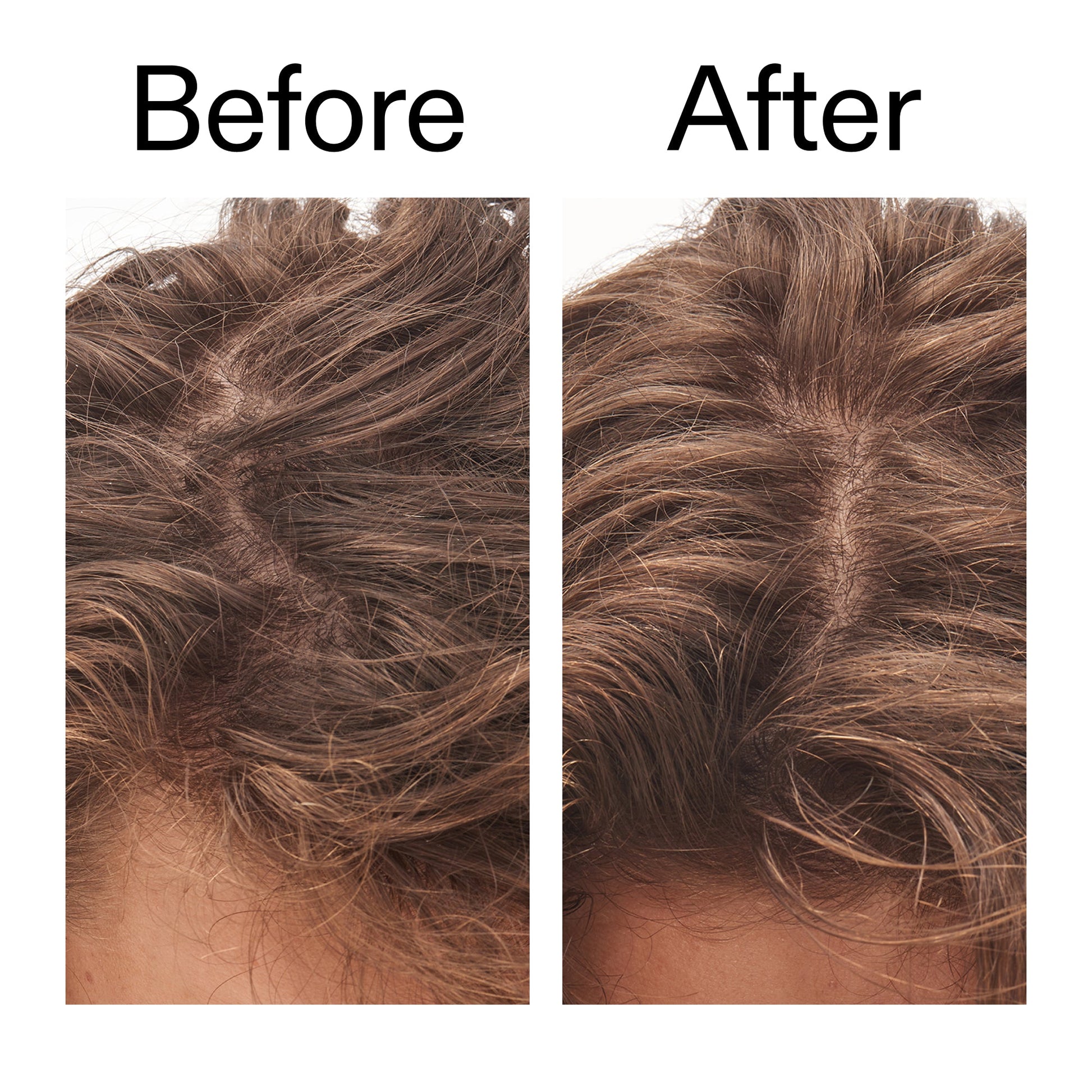 glycolic-acid-exfoliating-scalp-scrub-j1 Glycolic_Acid_Exfoliating_Scalp_Scrub_Before_After_2000x2000_b8561c87-05a1-4caa-80f7-1b6b33d750f7.jpg