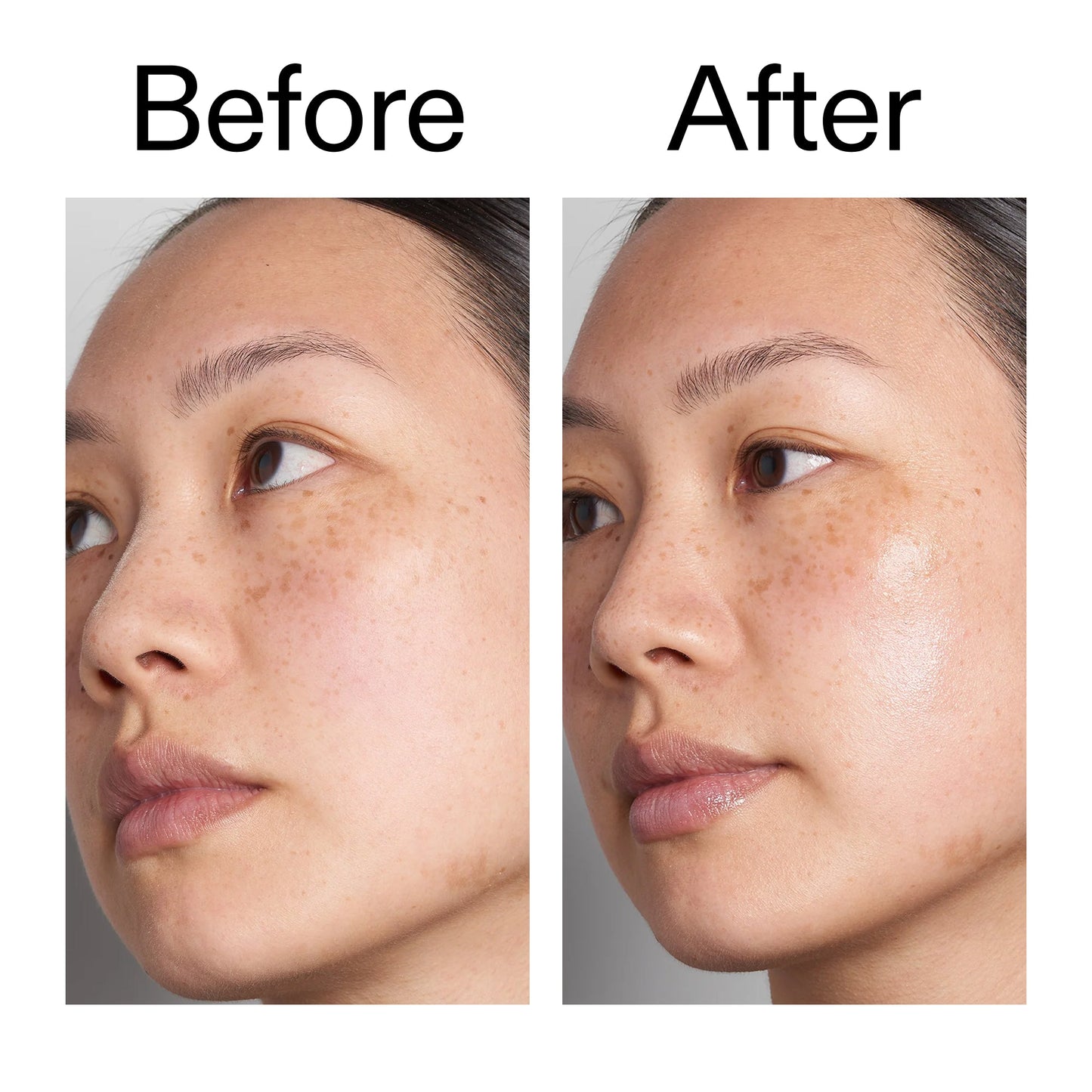 supersize-hyaluronic-acid-serum-100ml-h7 Hyaluronic_Acid_Before_After_2000x2000_d7983956-8aa2-4ea3-8255-c63e8d4f892e.jpg
