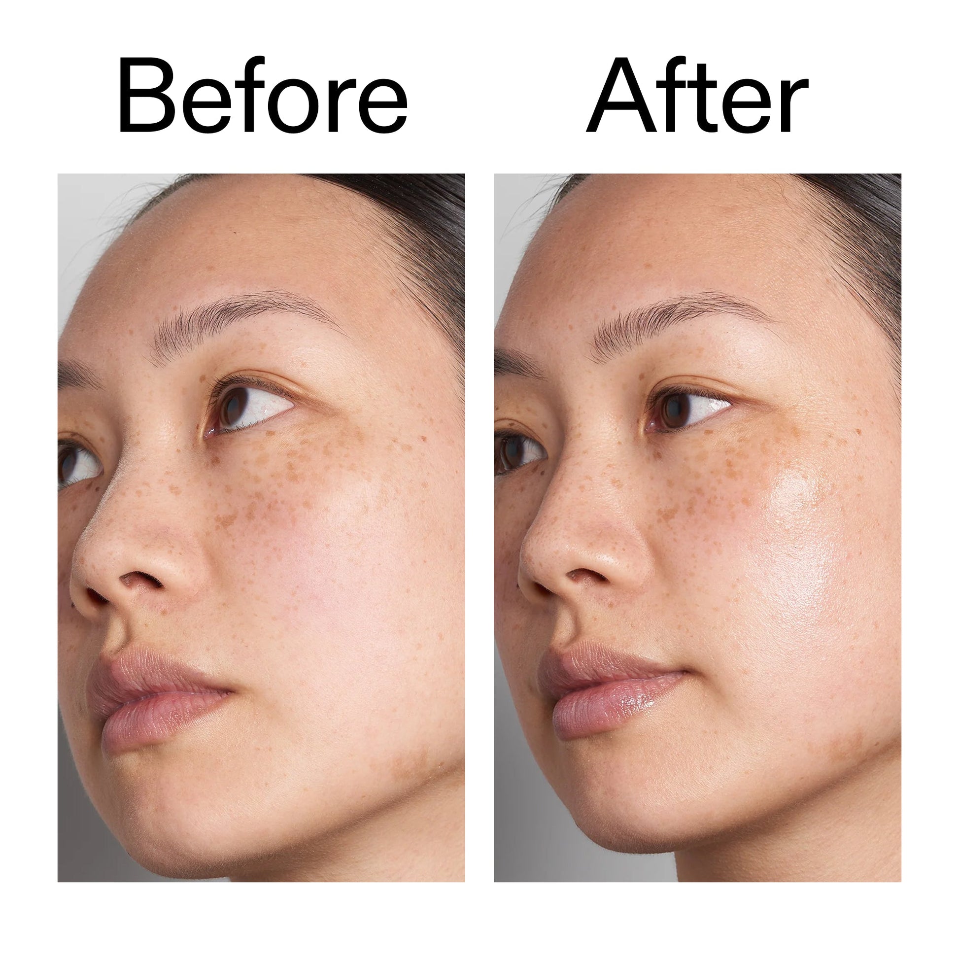 hyaluronic-acid-serum-30ml-b2 Hyaluronic_Acid_Before_After_2000x2000_d7983956-8aa2-4ea3-8255-c63e8d4f892e.jpg