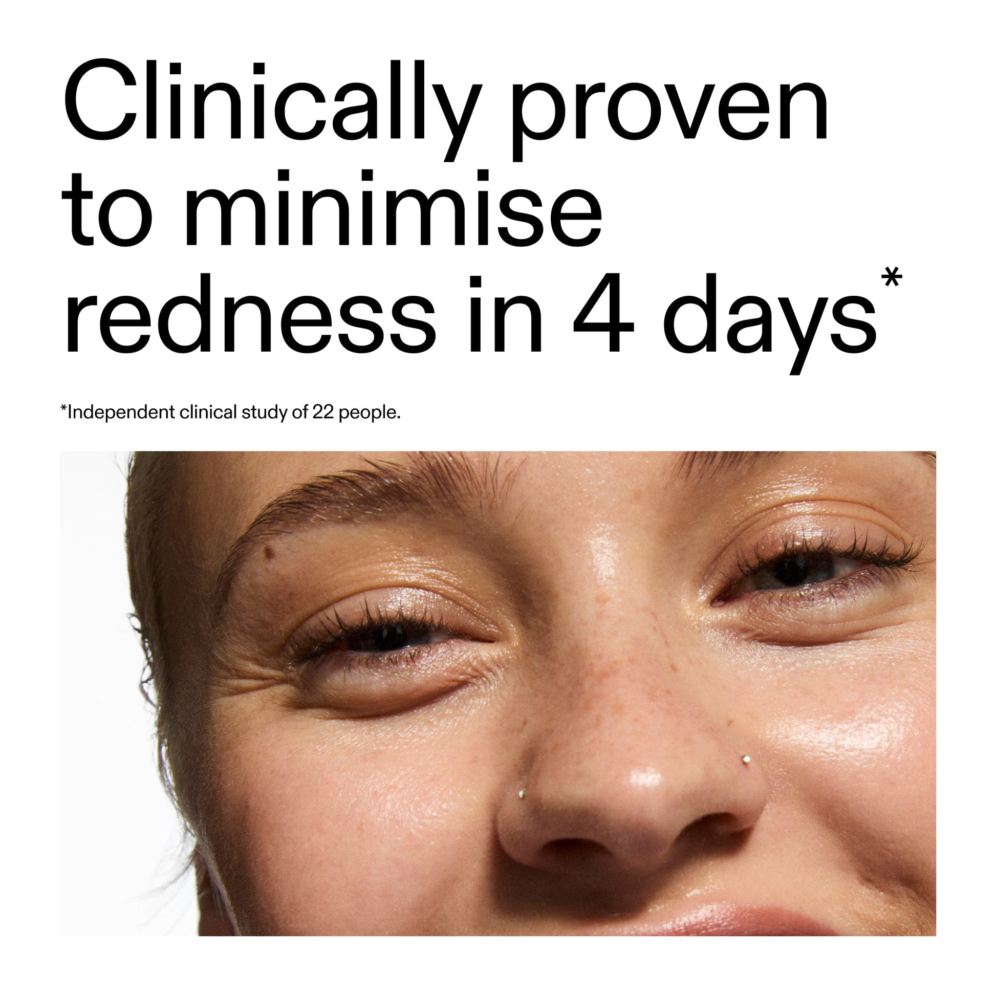 10-azelaic-acid-serum-for-redness-relief-k7 Oat_Cleansing_Balm_Claim_2000x2000_52a841dc-353c-4f2c-8646-3aadb604507d.jpg
