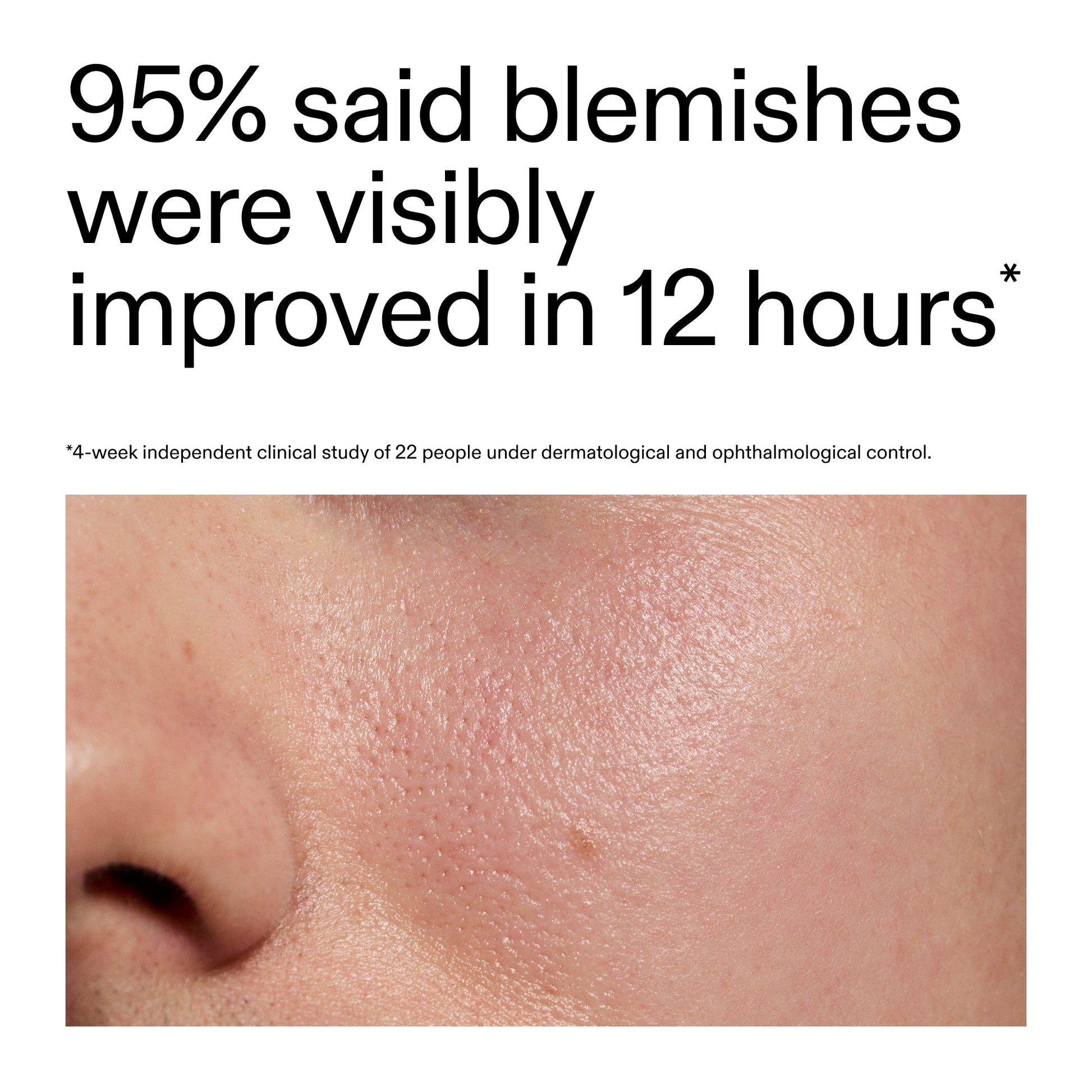 succinic-acid-acne-treatment-x3 Oat_Cleansing_Balm_Claim_2000x2000_ac6ce553-25db-41b2-a981-faae1ac4b8c0.jpg