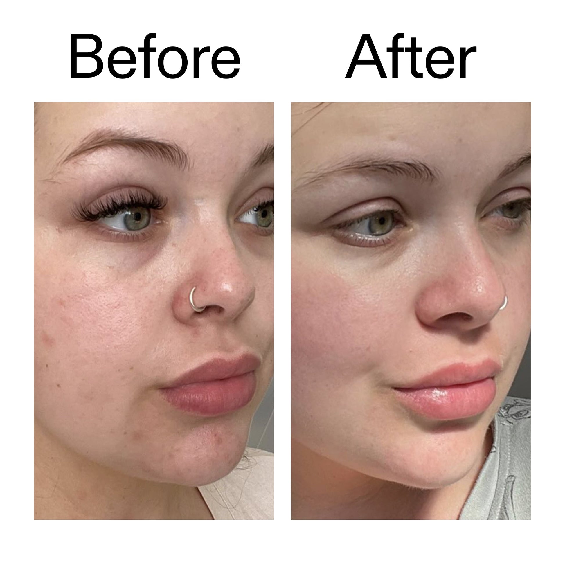 omega-water-cream-50ml-d0 Omega50_Before_After_2000x2000_46483ed8-3f9d-487f-9a0c-9df79830bd65.jpg