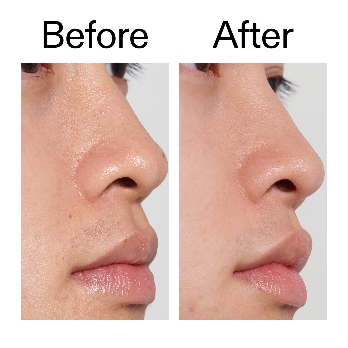 pha-toner-p7 PHA_Toner_Before_After_2000x2000_e3c10172-0150-4342-8b95-57417eaff50d.jpg
