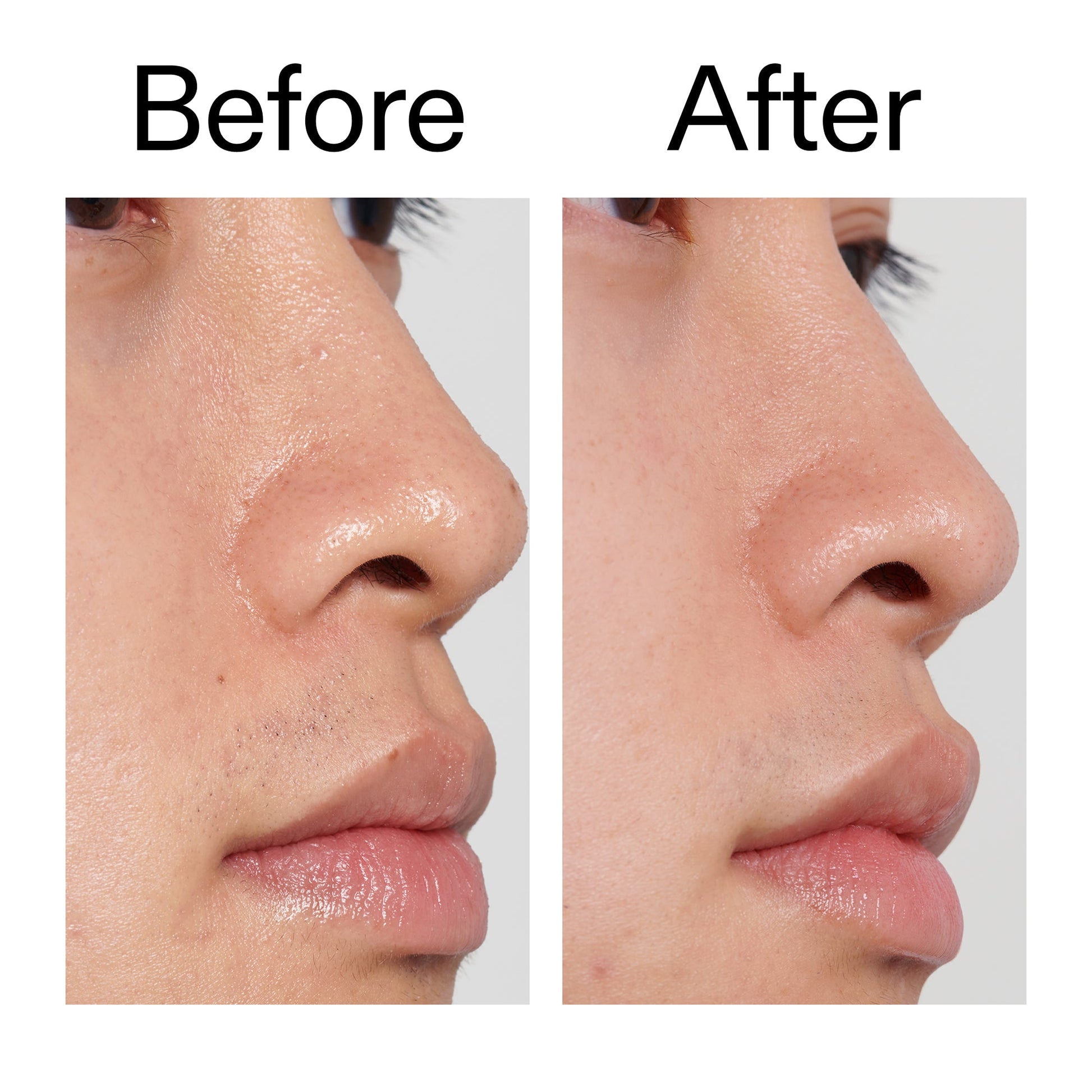 pha-toner-p7 PHA_Toner_Before_After_2000x2000_e3c10172-0150-4342-8b95-57417eaff50d.jpg