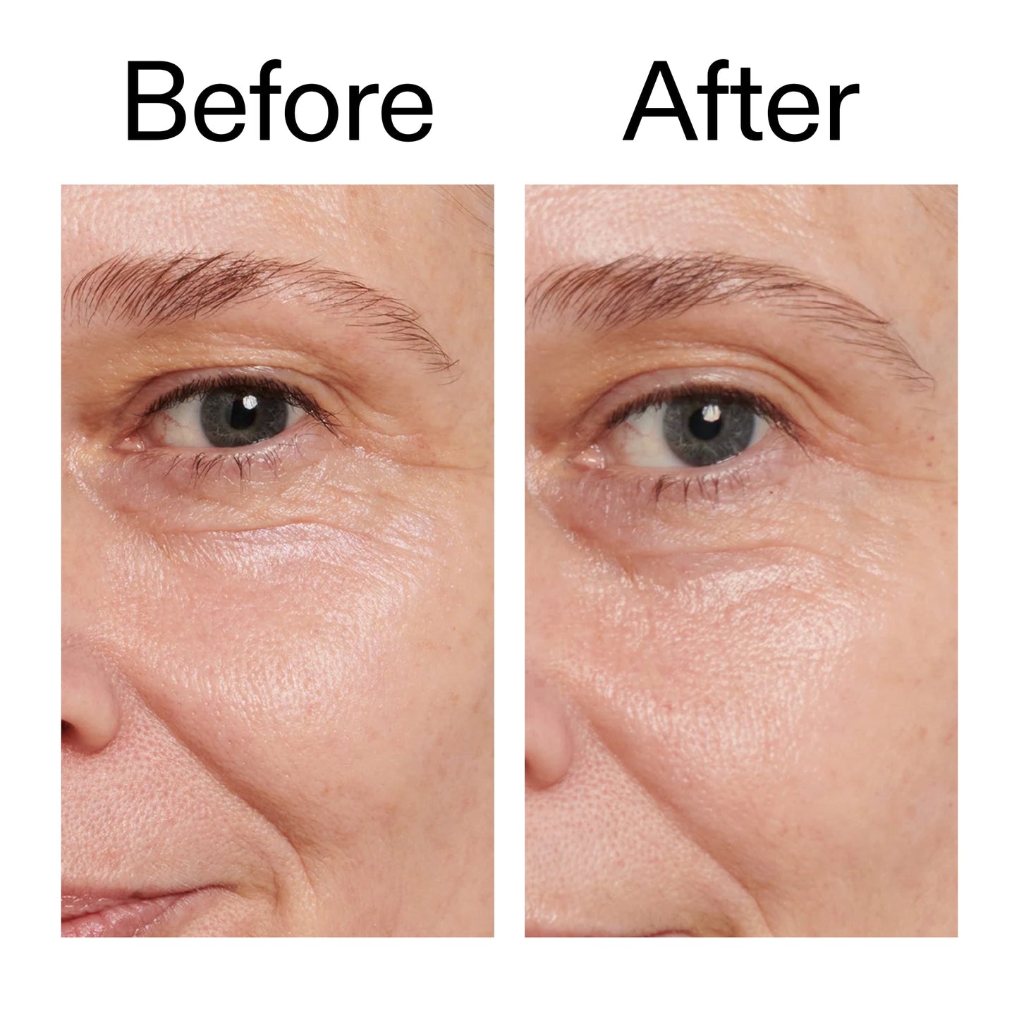 retinol-eye-cream-t5 Retinol_Eye_Cream_Before_After_2000x2000_ac03a80c-109e-4572-a95a-91dc109b4d27.jpg