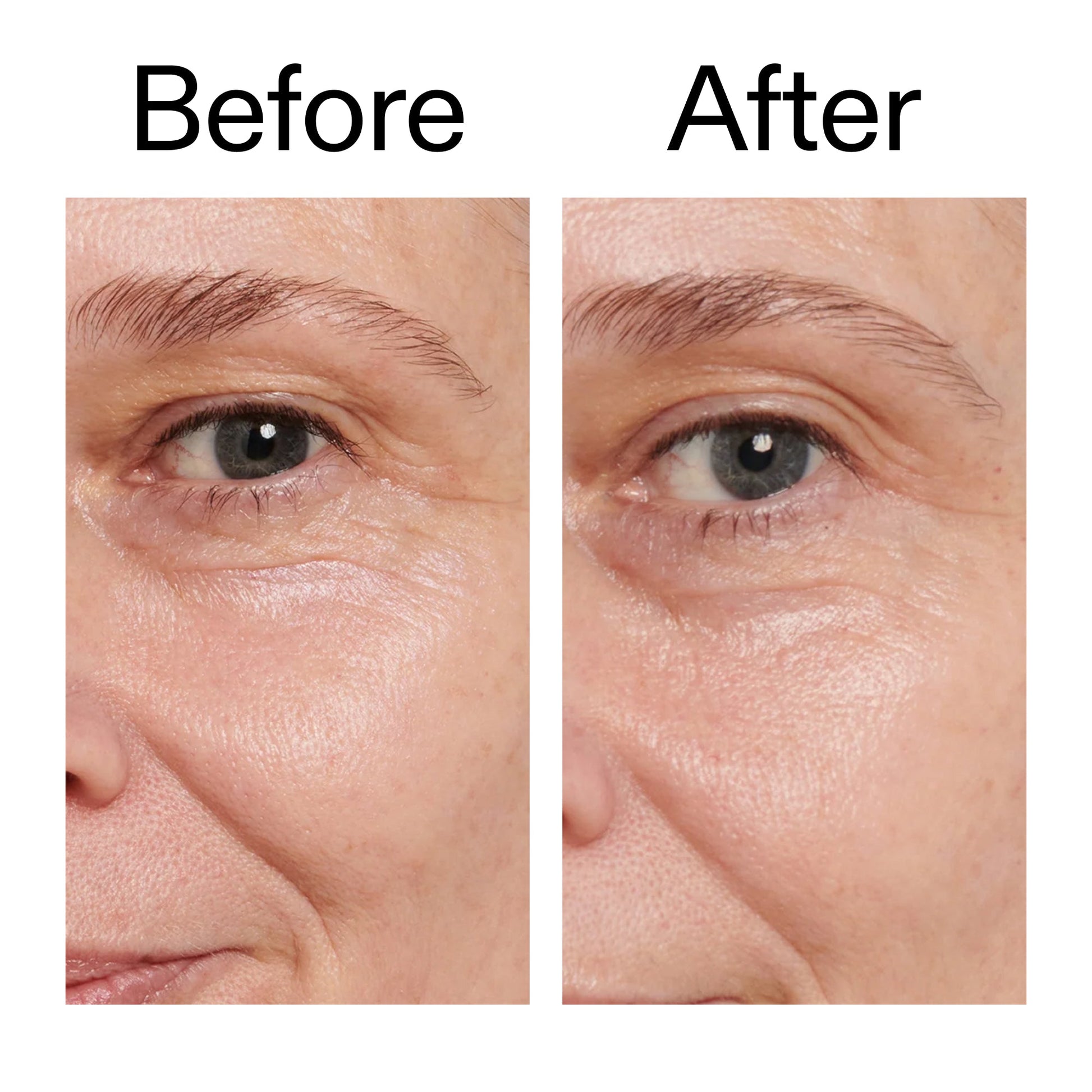 retinol-eye-cream-t5 Retinol_Eye_Cream_Before_After_2000x2000_ac03a80c-109e-4572-a95a-91dc109b4d27.jpg