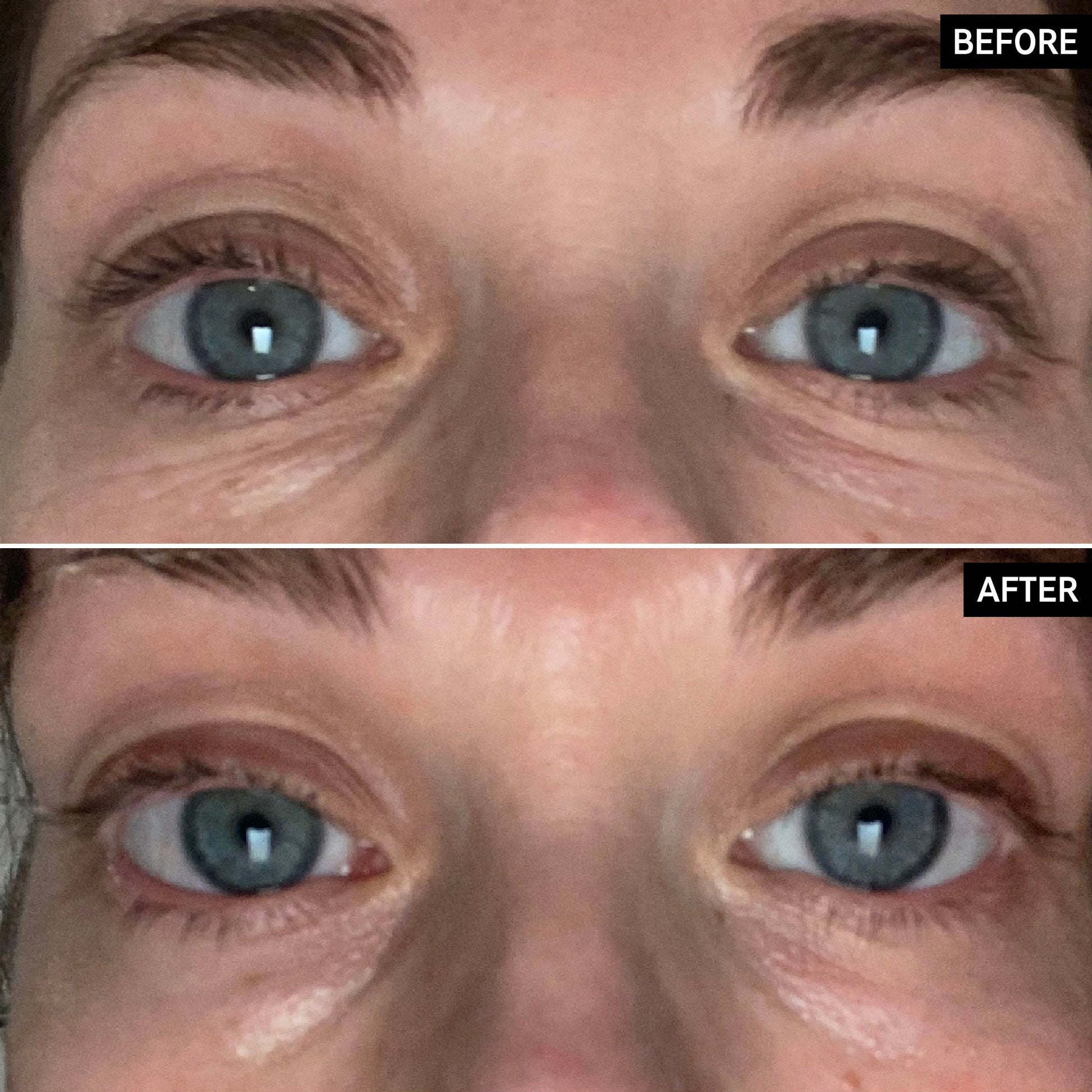 retinol-eye-cream-t5 SITE-UGCBAsApril_Nicole_B_A_PPage_2000x2000_1.jpg