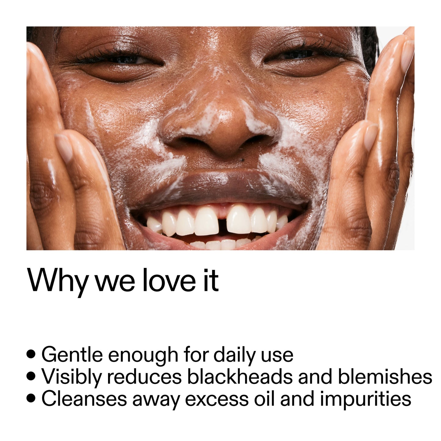 salicylic-acid-cleanser-duo-b4 Salicylic_Acid_Cleanser_-_300mlWhy_we_love_it_2000x2000_87dc92a9-2559-4309-98cd-4e570f1be735.jpg