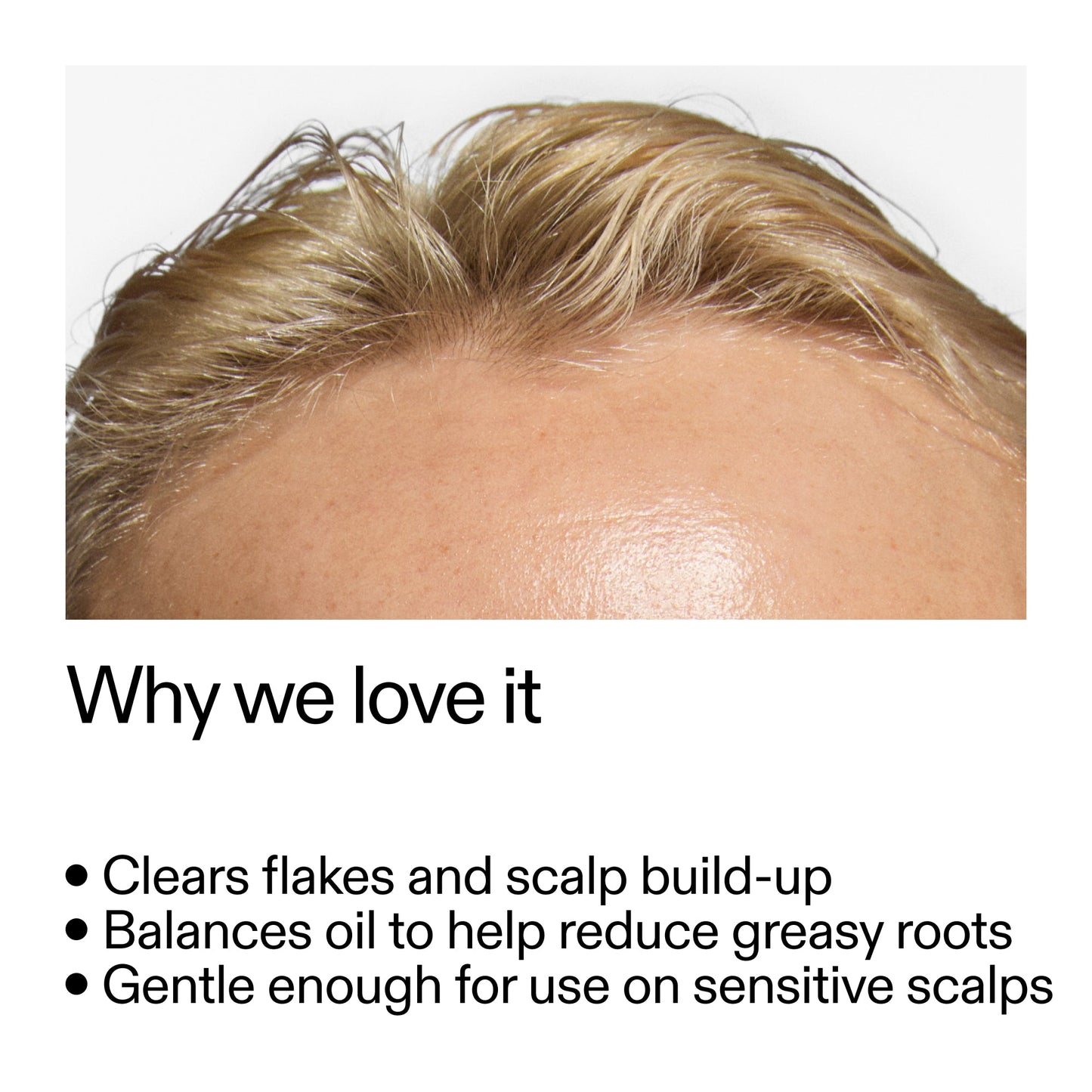 salicylic-acid-exfoliating-scalp-treatment-v8 Salicylic_Acid_Exfoliating_Scalp_Treatment_Why_we_love_it_2000x2000_44b6bd6d-9ec4-4b23-9dc4-bc3fd6f28e14.jpg
