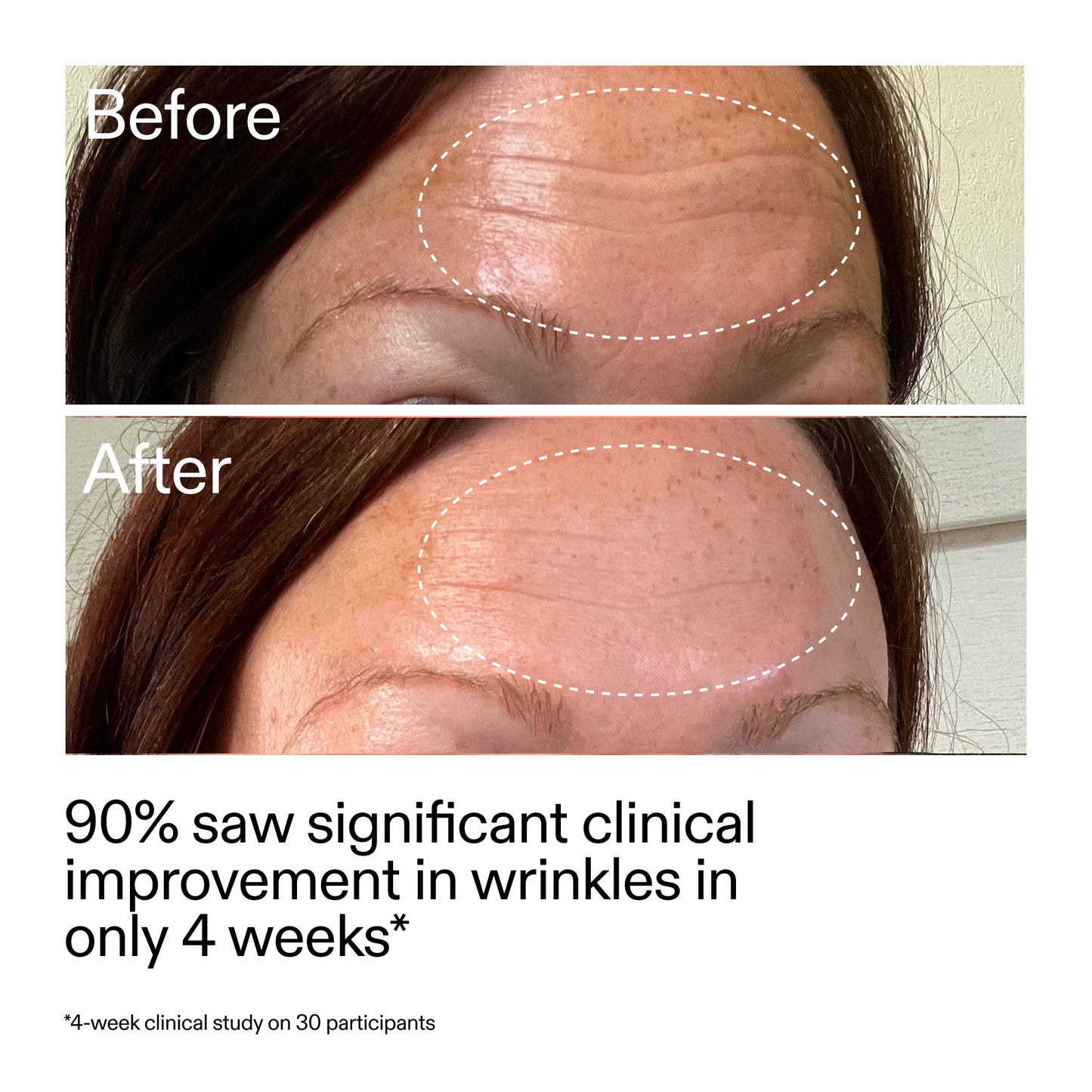 starter-retinol-serum-duo-t0 StarterRetinol_BeforeAfter_Claim1_2000x2000_03b4d6e5-a357-43b9-a855-aba5e35c57f3.jpg