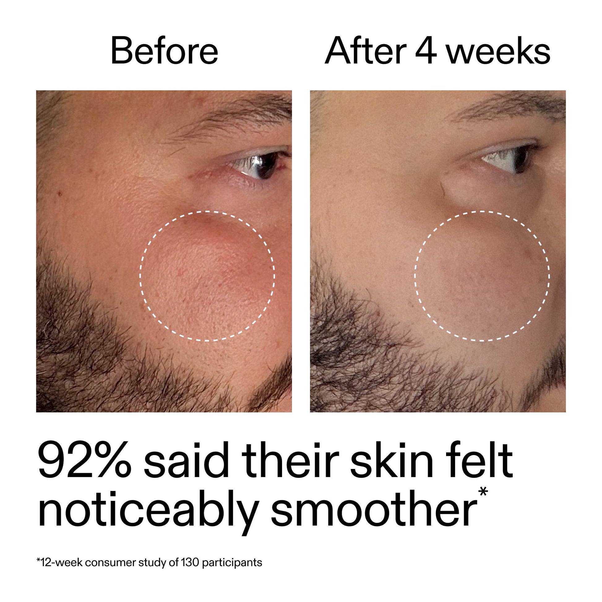 starter-retinol-serum-y5 StarterRetinol_BeforeAfter_Claim3_2000x2000_6ceab106-e0ee-4ed4-ba62-41bc39538038.jpg
