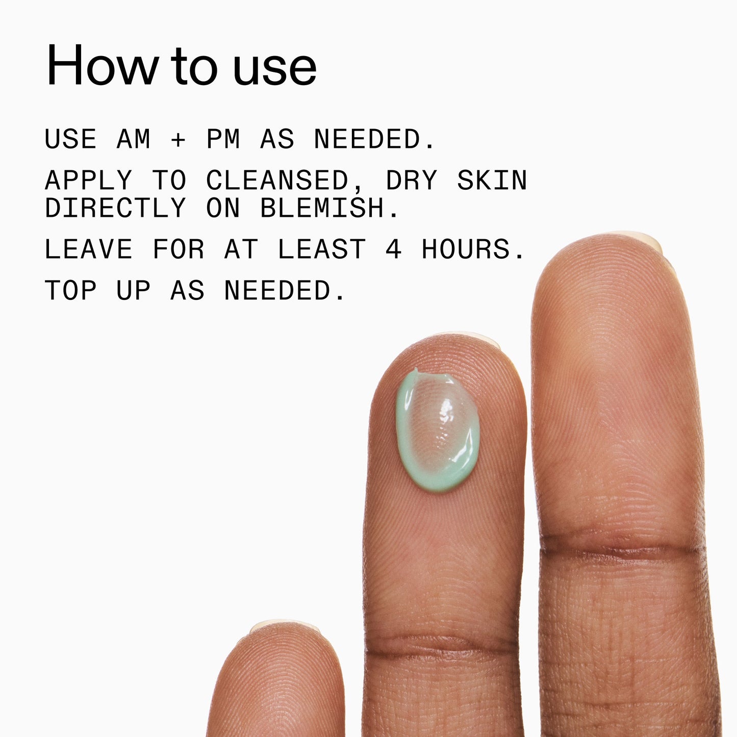 succinic-acid-acne-treatment-x3 Succinic_Acid_Treatment_How_to_Use_2000x2000_d57137d5-d7f1-427c-9a46-5fc00c19c542.jpg
