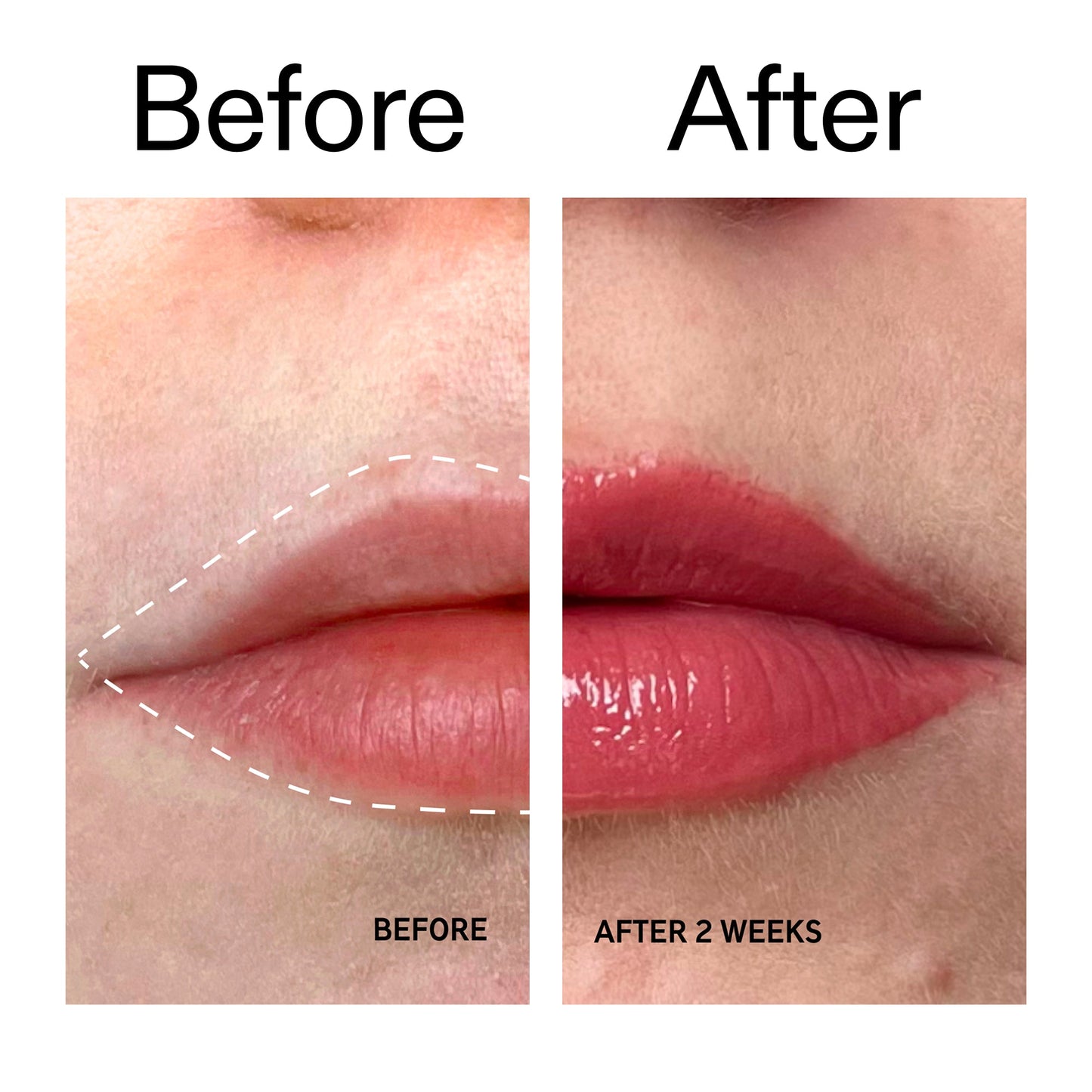 tripeptide-plumping-berry-lip-balm-x5 Tripeptide_Plumping_Lip_Balm_-_Berry_Before_After_2000x2000_9474bbd8-43ca-4b0e-b0e7-dfab70b91927.jpg